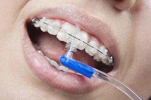 ortho_hygene